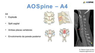 Aospine Score Fratura Cervical Subaxial | PPT