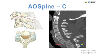 Fratura Cervical Subaxial | PPT