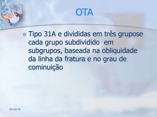 OTA
 Tipo 31A e divididas em três grupose
cada grupo subdividido em
subgrupos, baseada na obliquidade
da linha da fratura e no grau de
cominuição
05/10/19
 
