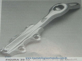 05/10/19
www.traumatologiaeortopedia.com.br
 