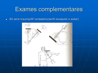 Exames complementares
 RX serie trauma(AP verdadeiro/perfil escapular e axilar)
 