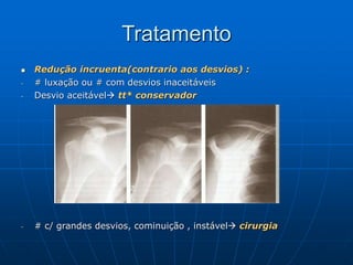 Tratamento
 Redução incruenta(contrario aos desvios) :
- # luxação ou # com desvios inaceitáveis
- Desvio aceitável tt* conservador
- # c/ grandes desvios, cominuição , instável cirurgia
 