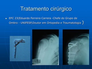 Tratamento cirúrgico
 EFC 23(Eduardo Ferreira Carrera -Chefe do Grupo de
Ombro - UNIFESP,Doutor em Ortopedia e Traumatologia )
 