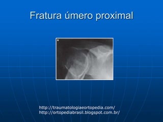 Fratura úmero proximal
http://traumatologiaeortopedia.com/
http://ortopediabrasil.blogspot.com.br/
 