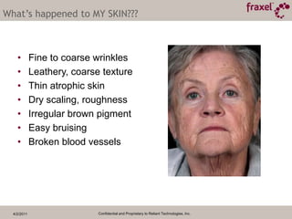 4/2/2011Confidential and Proprietary to Reliant Technologies, Inc.What’s happened to MY SKIN???Fine to coarse wrinkles