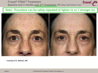 4/2/2011Confidential and Proprietary to Reliant Technologies, Inc.