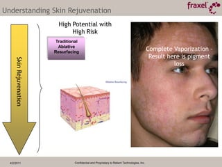 Dry scaling, roughness