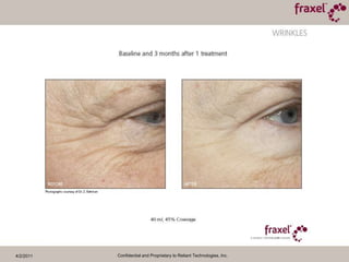 4/2/2011Confidential and Proprietary to Reliant Technologies, Inc.