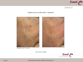 4/2/2011Confidential and Proprietary to Reliant Technologies, Inc.