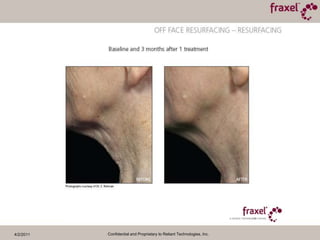 4/2/2011Confidential and Proprietary to Reliant Technologies, Inc.