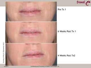 4/2/2011Confidential and Proprietary to Reliant Technologies, Inc.