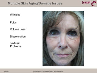 Broken blood vessels4/2/2011Confidential and Proprietary to Reliant Technologies, Inc.Un-aging – Can I DO that??I’d love to turn back the clock…but how?Sunblocks, moisturizers, topicalscosmeceuticals, sun avoidance, superficial skin treatments.