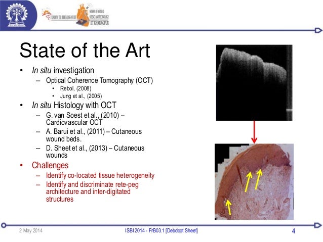 Optical coherence tomography phd thesis