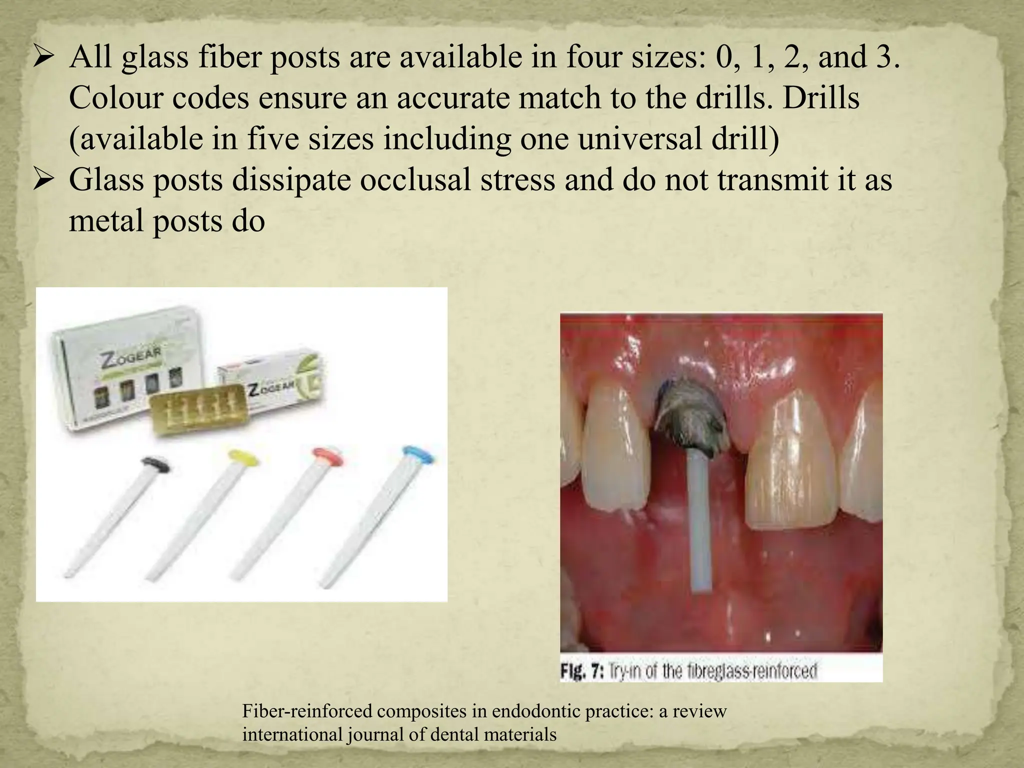 FIBRE REINFORCED COMPOSITE USEC IN CONSERVATIVE DENTISTRY AND ...