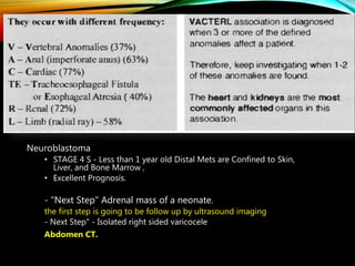 Neuroblastoma
• STAGE 4 S - Less than 1 year old Distal Mets are Confined to Skin,
Liver, and Bone Marrow ,
• Excellent Prognosis.
- "Next Step" Adrenal mass of a neonate.
the first step is going to be follow up by ultrasound imaging
- Next Step" - Isolated right sided varicocele
Abdomen CT.
 