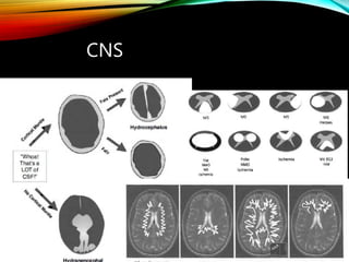 CNS
 