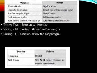 • This vs That - Esophageal Hernias
• Sliding - GE Junction Above the Diaphragm
• Rolling - GE Junction Below the Diaphragm
 