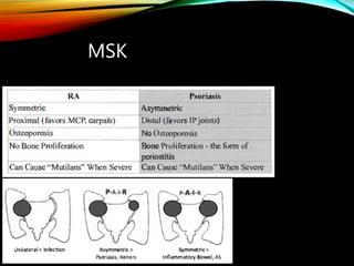 MSK
 
