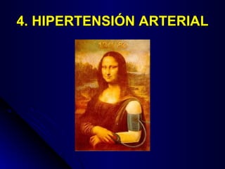 4. HIPERTENSIÓN ARTERIAL 