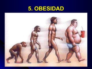 5. OBESIDAD 