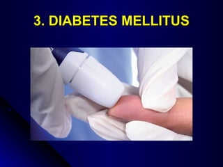 3. DIABETES MELLITUS 