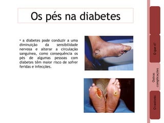 Os pés na diabetes a diabetes pode conduzir a uma diminuição da sensibilidade nervosa e alterar a circulação sanguínea, como consequência os pés de algumas pessoas com diabetes têm maior risco de sofrer feridas e infecções. 