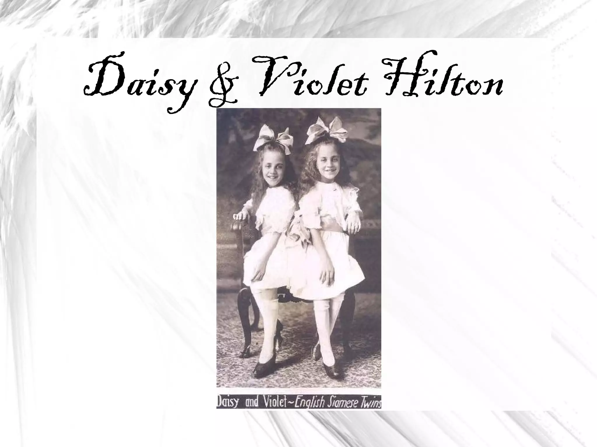 Daisy & Violet Hilton
 