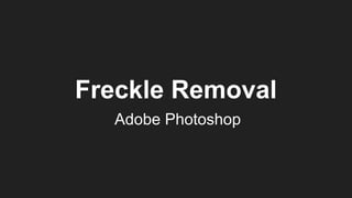 Freckle Removal
Adobe Photoshop
 