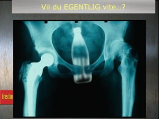 Vil du EGENTLIG vite…?
 