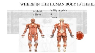 a. Chest b. Hip or pelvis
c. Knee d.
Brain
 