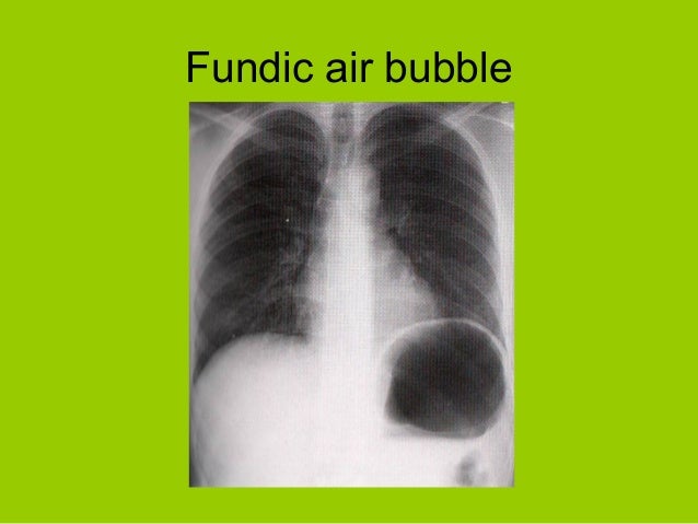 analysis of abdominal x-ray gas.