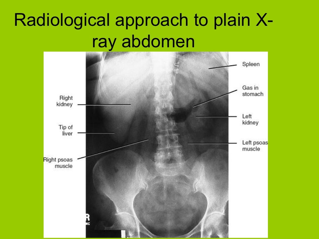 analysis of abdominal xray gas.