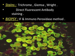 • Stains : Trichrome , Giemsa , Wright .
• Direct Fluorescent Antibody
staining .
• BIOPSY : IF & Immuno Peroxidase method .
 