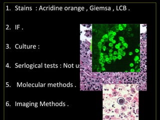 1. Stains : Acridine orange , Giemsa , LCB .
2. IF .
3. Culture :
4. Serlogical tests : Not useful .
5. Molecular methods .
6. Imaging Methods .
 