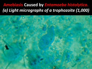Amebiasis Caused by Entamoeba histolytica.
(a) Light micrographs of a trophozoite (1,000)
 