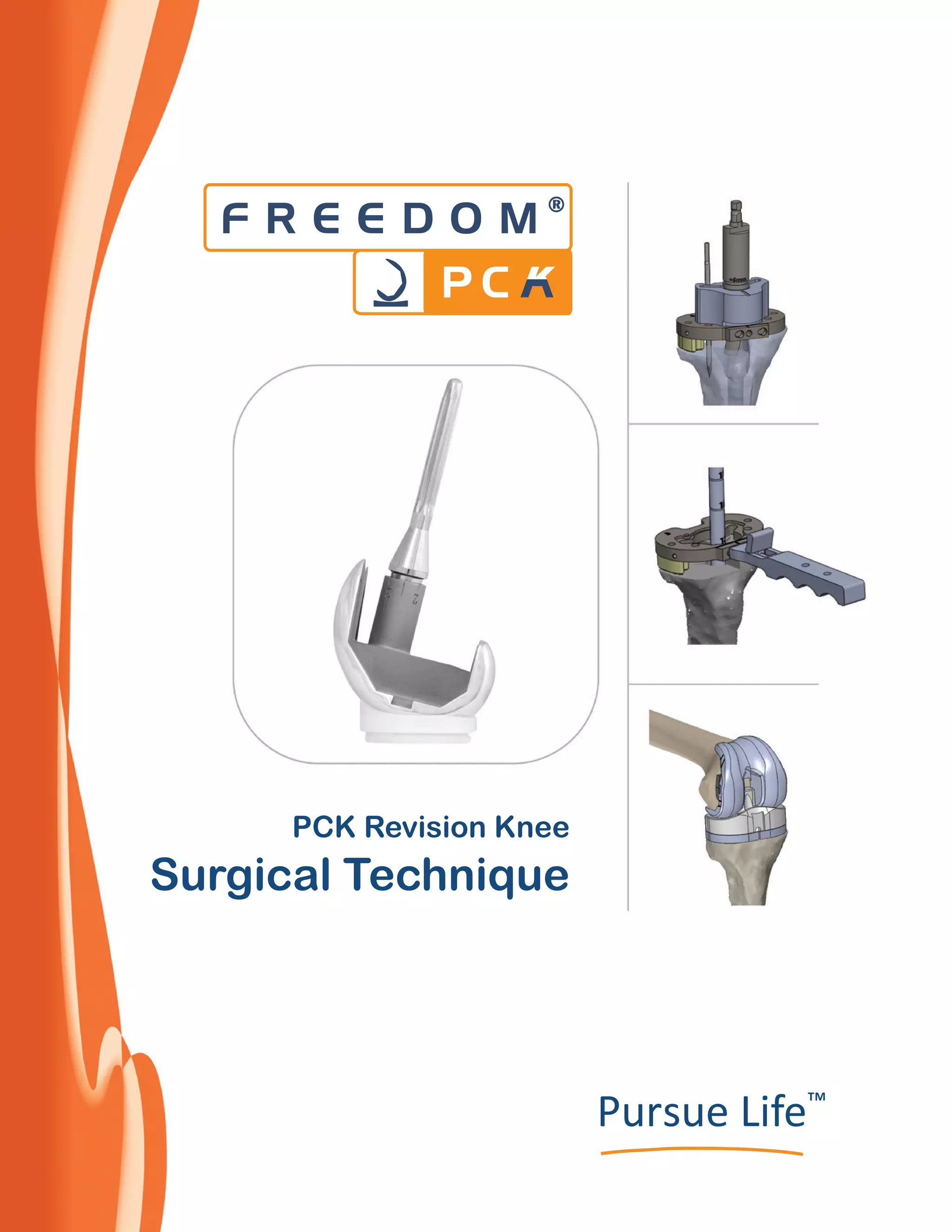 Freedom pck revision knee system by meril life | PDF