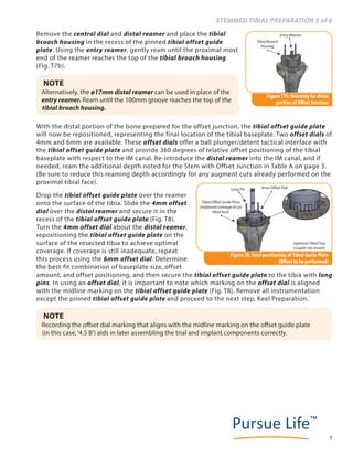 Freedom pck revision knee system by meril life | PDF