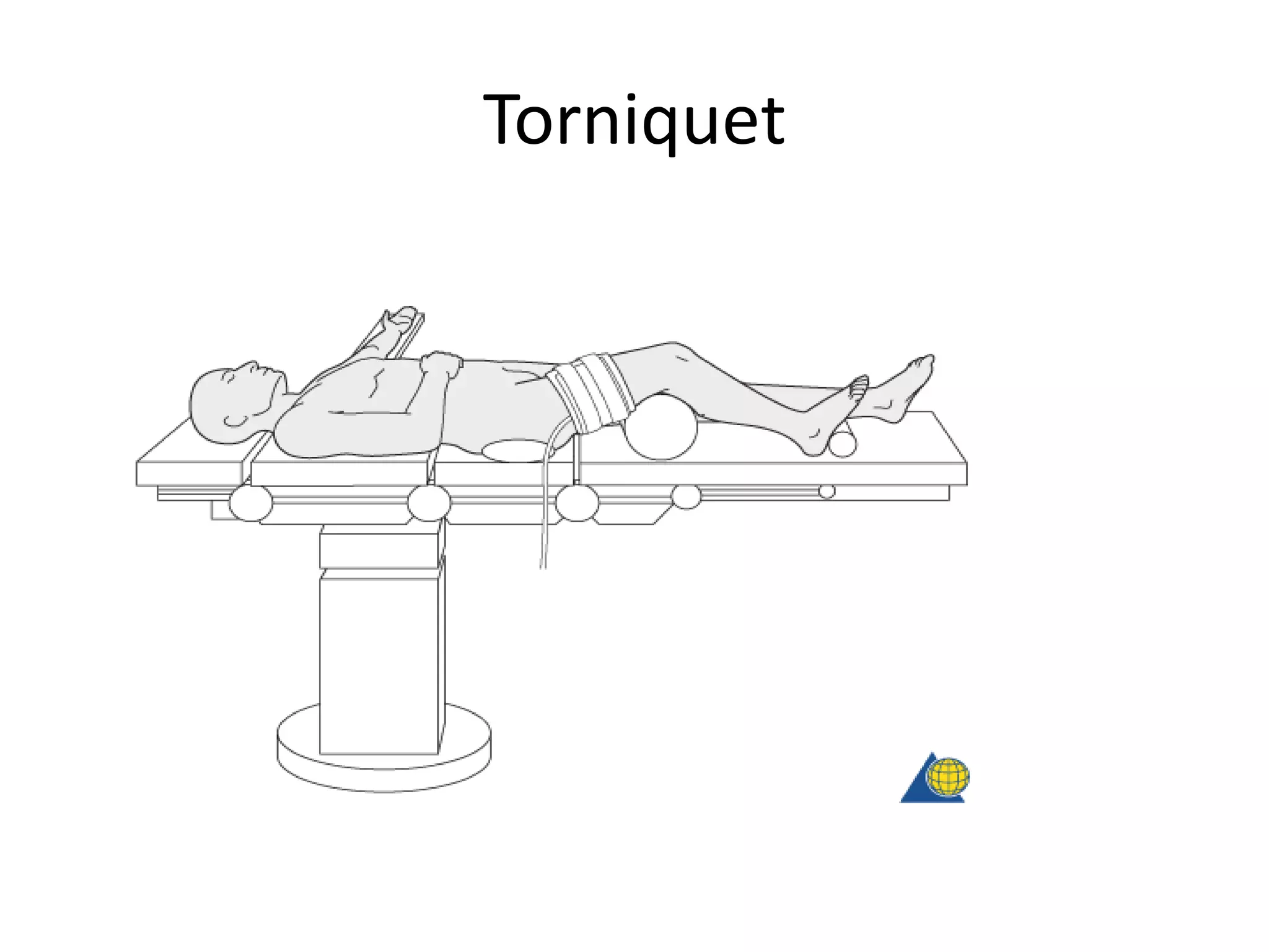Torniquet
 