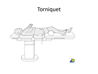 Torniquet
 