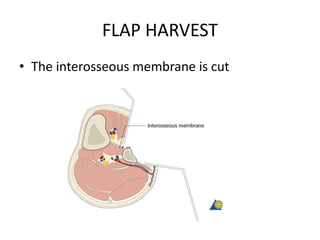 FLAP HARVEST
• The interosseous membrane is cut
 