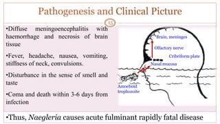 Pathogenesis and Clinical Picture
Amoeboid
trophozoite
Nasal mucosa
Cribriform plate
Olfactory nerve
Brain, meninges
•Diffuse meningoencephalitis with
haemorrhage and necrosis of brain
tissue
•Fever, headache, nausea, vomiting,
stiffness of neck, convulsions.
•Disturbance in the sense of smell and
taste
•Coma and death within 3-6 days from
infection
•Thus, Naegleria causes acute fulminant rapidly fatal disease
15
 