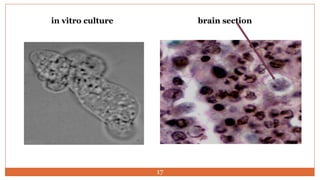 brain sectionin vitro culture
17
 