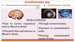 A. Granulomatous Amoebic Encephalitis B. Acanthamoeba Keratitis
Mode of infection
•Nose to Lower respiratory
tract to Blood to Brain
•Ulcerated skin and mucosa to
Blood to Brain
•Through corneal trauma
•Exposure to contaminated
water
•Wearing contaminated
contact lenses
Acanthamoeba spp.
18
 