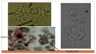 Cyst
Trophozoite22
 