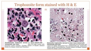 Trophozoite form stained with H & E
33
 