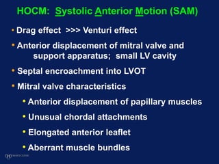 • Drag effect >>> Venturi effect
• Anterior displacement of mitral valve and
support apparatus; small LV cavity
• Septal encroachment into LVOT
• Mitral valve characteristics
• Anterior displacement of papillary muscles
• Unusual chordal attachments
• Elongated anterior leaflet
• Aberrant muscle bundles
HOCM: Systolic Anterior Motion (SAM)
 