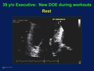 39 y/o Executive: New DOE during workouts
Rest
 