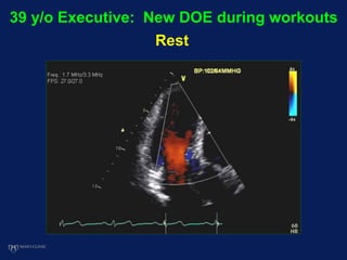 39 y/o Executive: New DOE during workouts
Rest
 