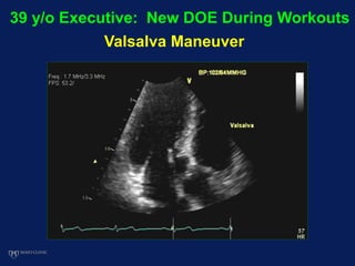 39 y/o Executive: New DOE During Workouts
Valsalva Maneuver
 
