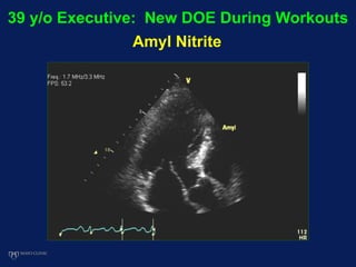 39 y/o Executive: New DOE During Workouts
Amyl Nitrite
 